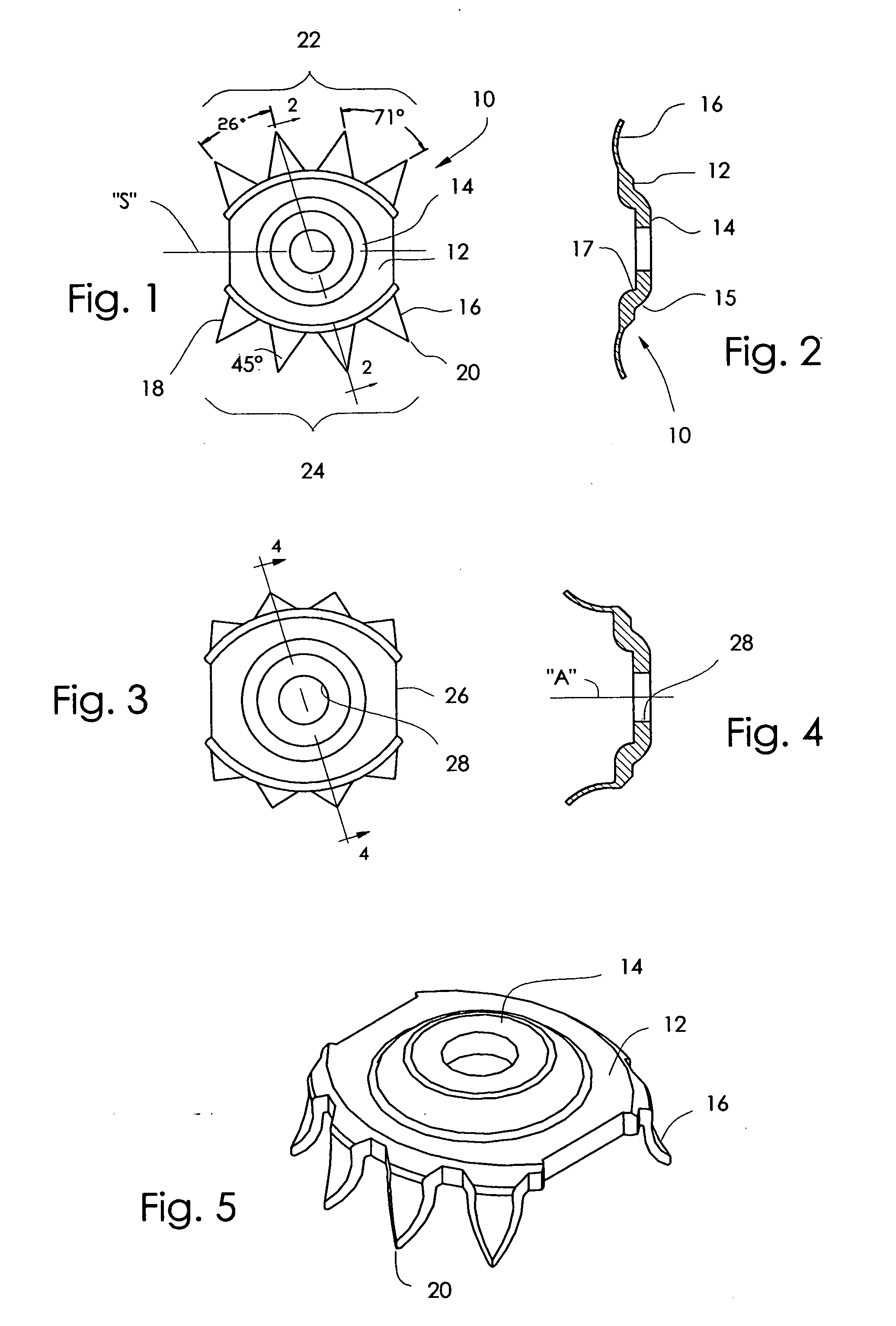 Ring binder mechanism with pronged metal anchors