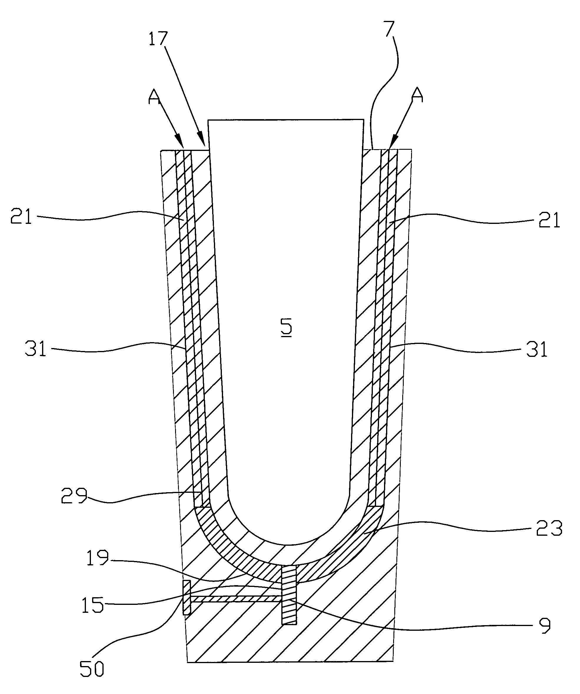 Prosthetic interior casting process and product