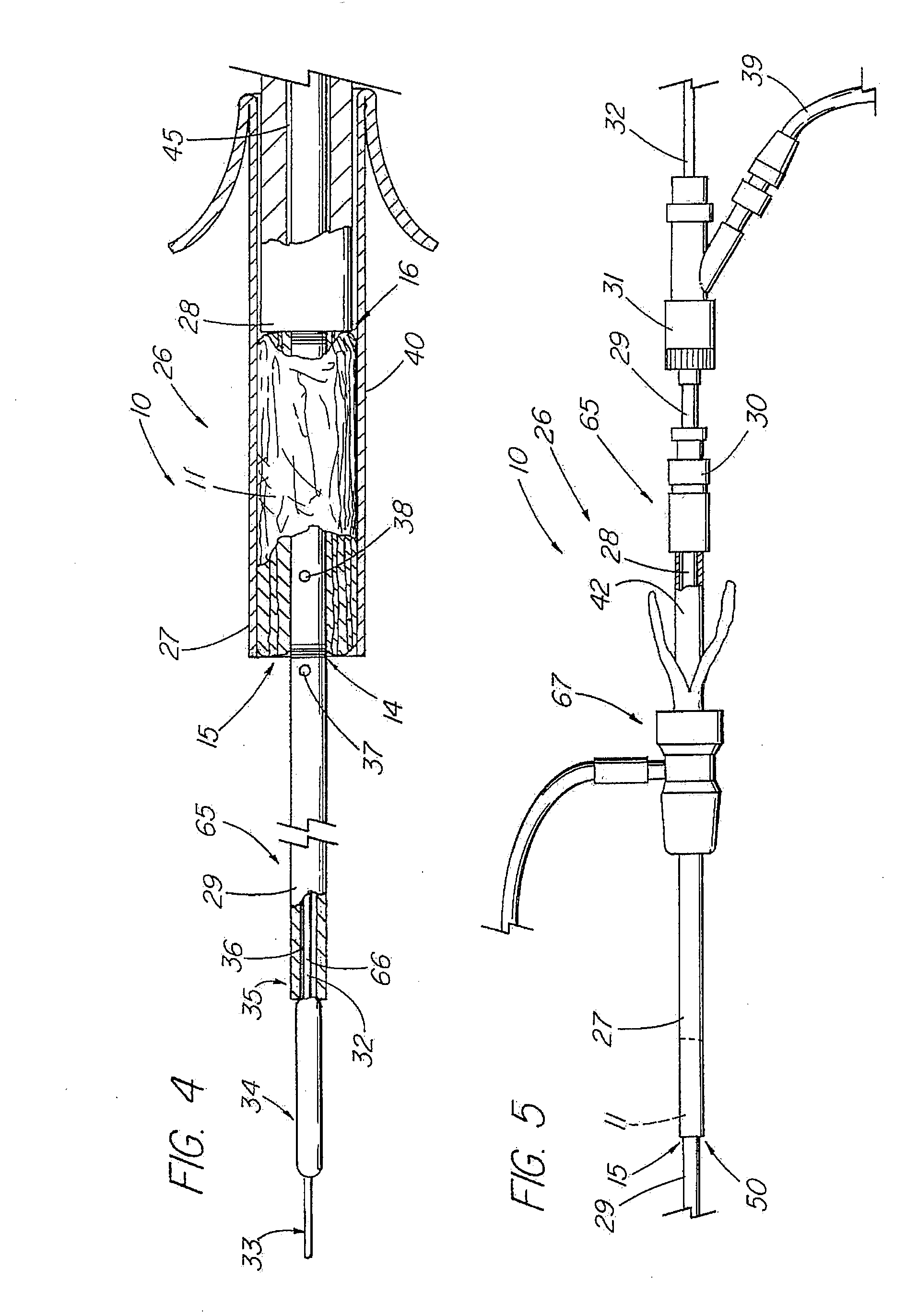 Bodily lumen closure apparatus and method