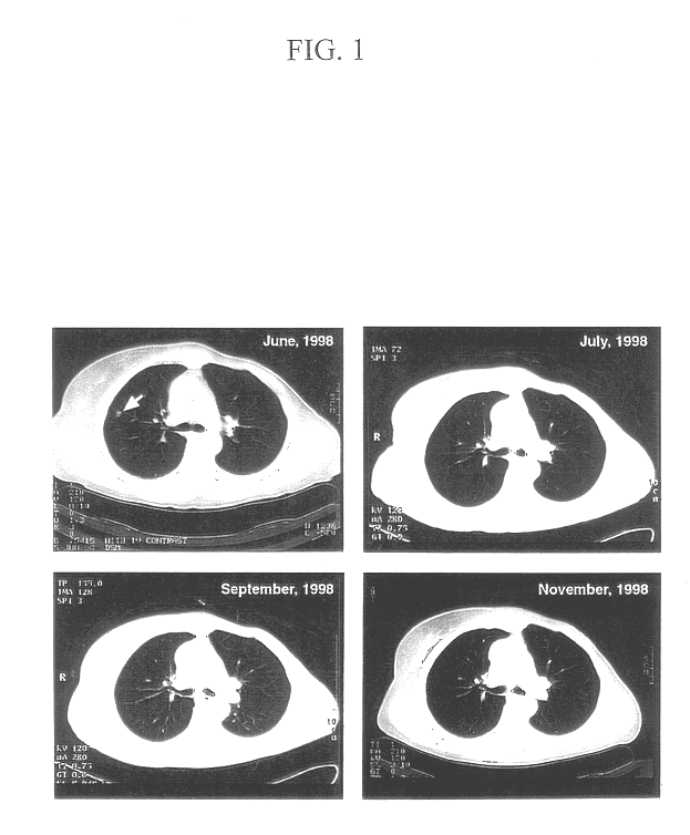 Composition and method of cancer antigen immunotherapy