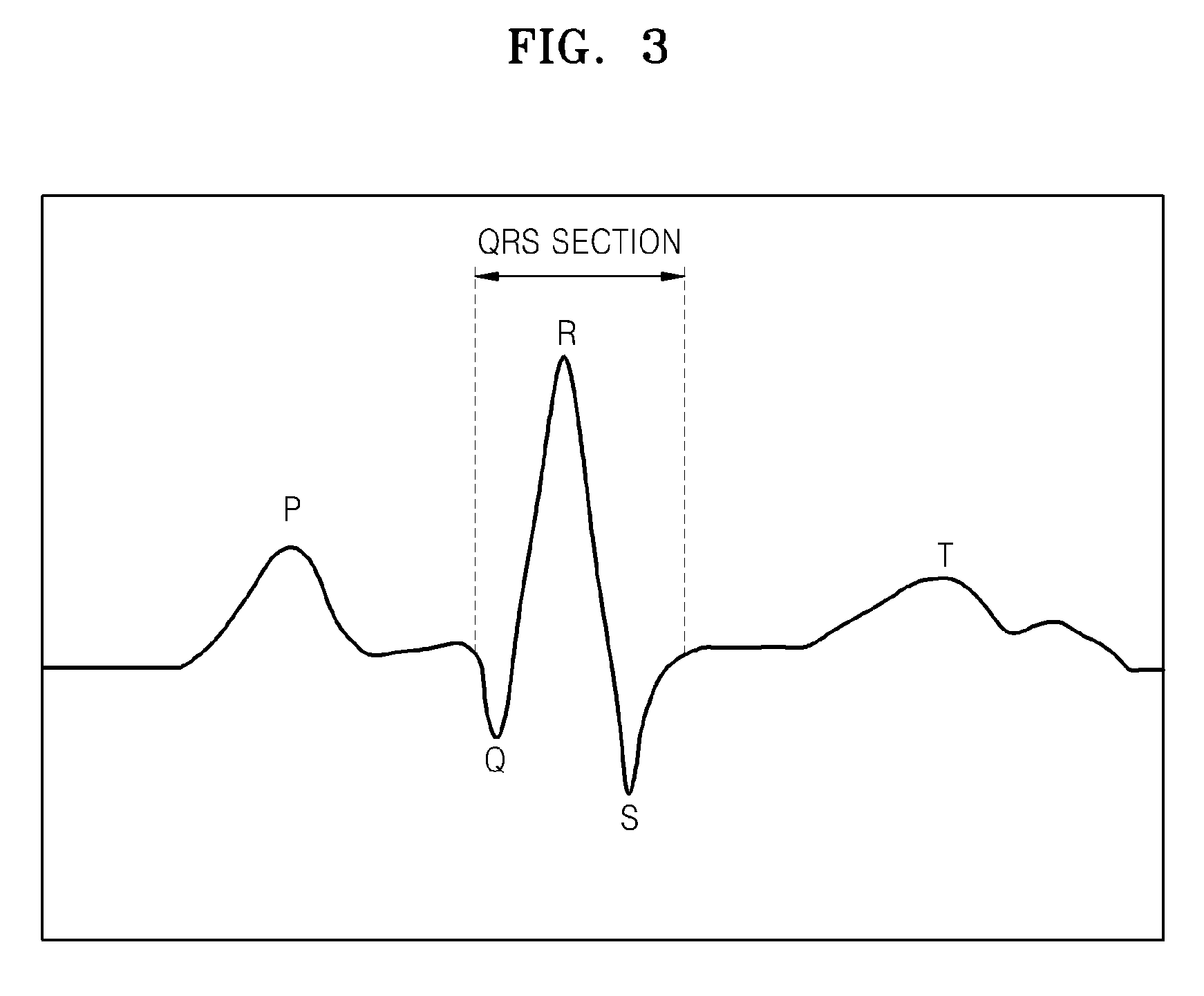 Ultrasound system and method of obtaining ultrasound image