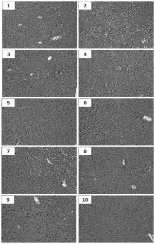 Ginsenoside composition with function of preventing and treating alcoholic fatty liver