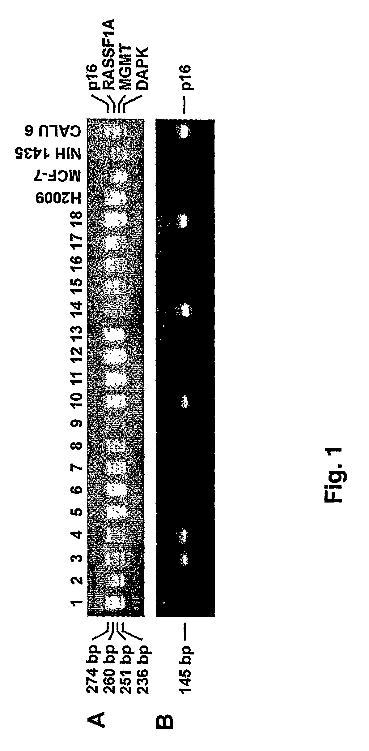 Gene methylation as a biomarker in sputum