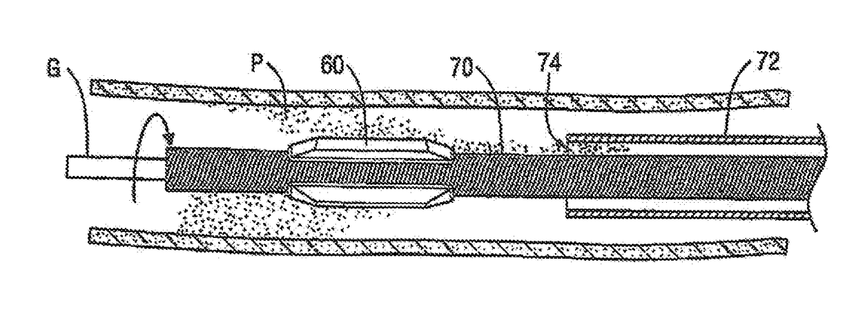 Atherectomy device