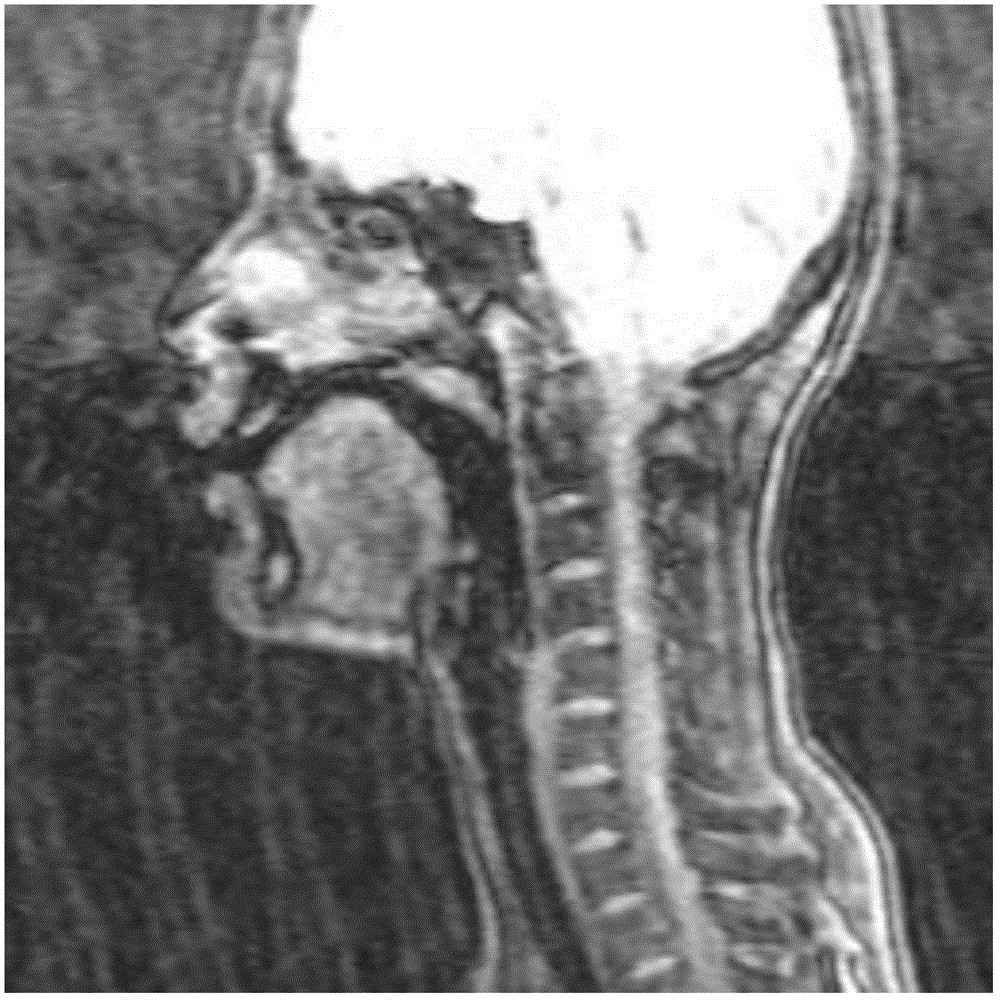 Automatic tongue contour extraction method based on nuclear magnetic resonance images