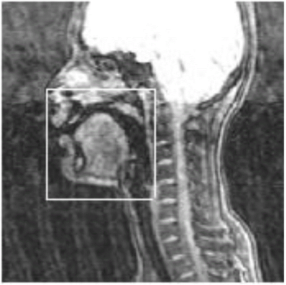 Automatic tongue contour extraction method based on nuclear magnetic resonance images