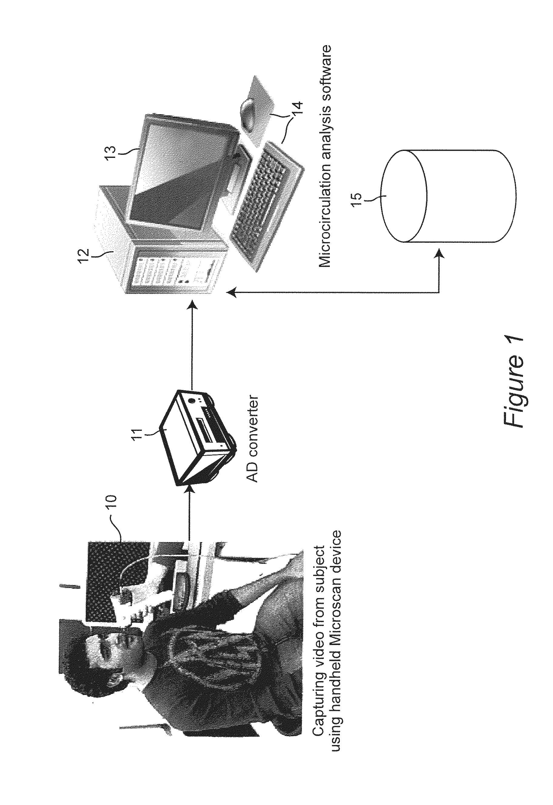 Image Processing and Machine Learning for Diagnostic Analysis of Microcirculation