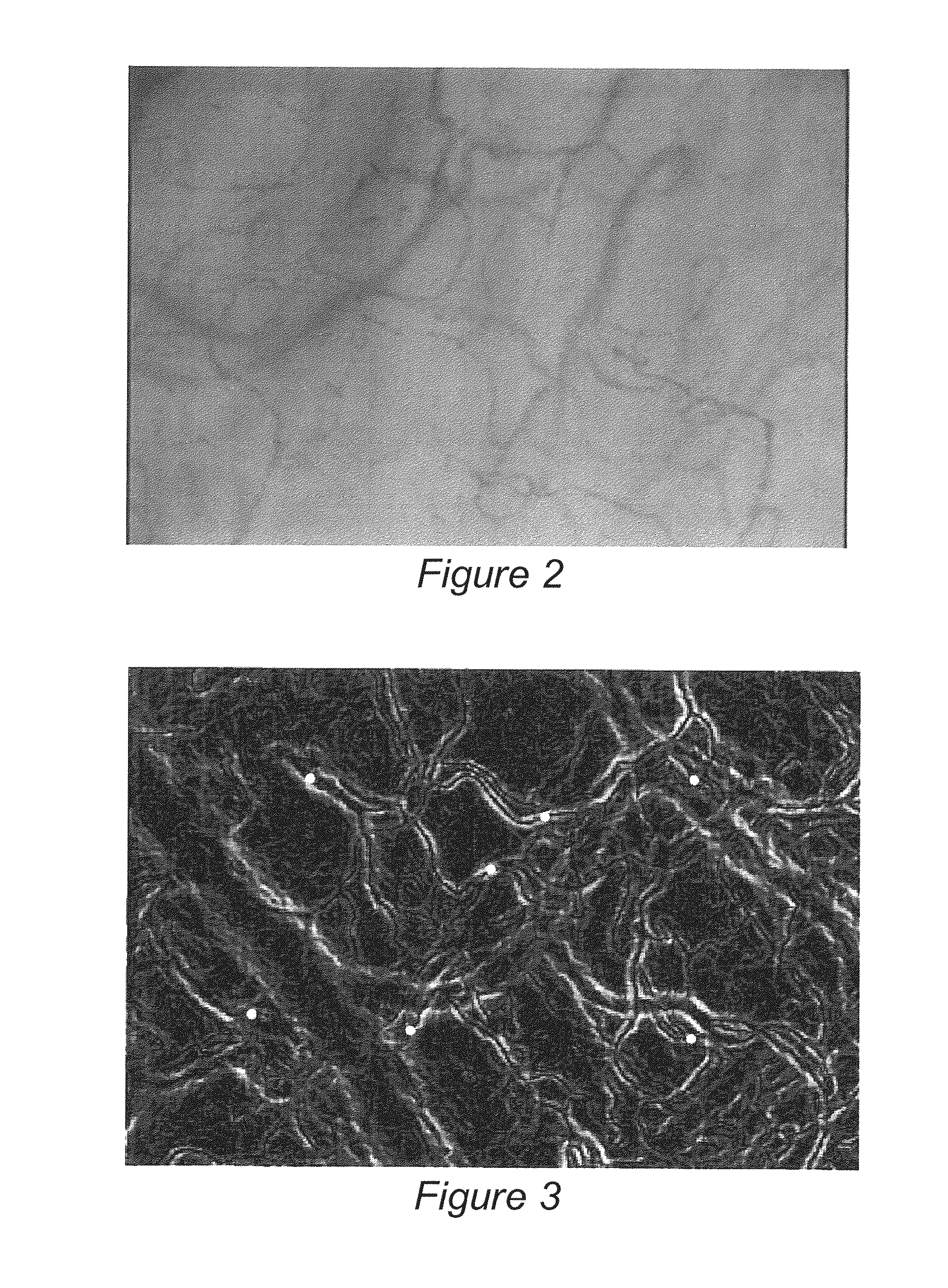 Image Processing and Machine Learning for Diagnostic Analysis of Microcirculation