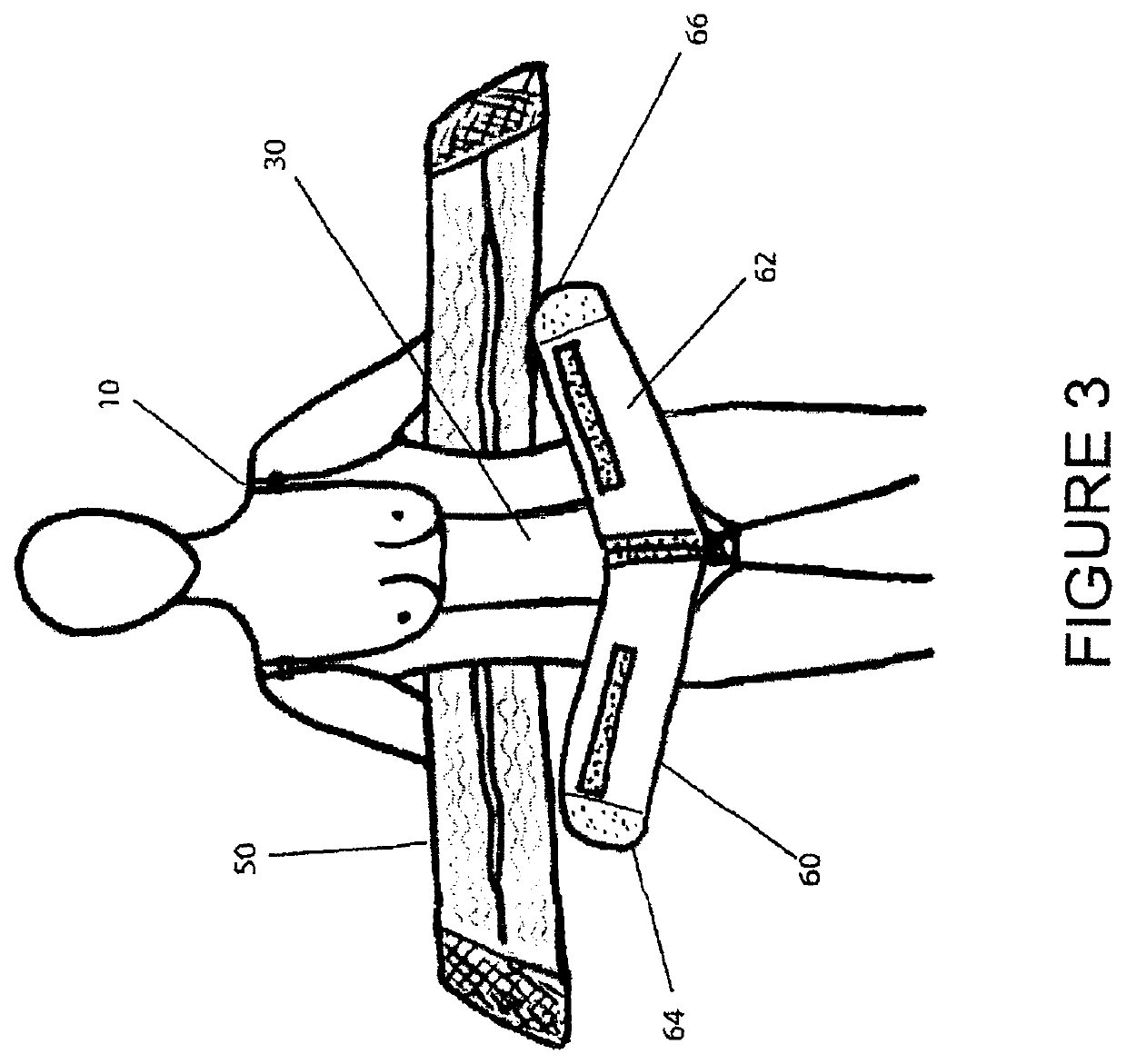 Diastasis recti splinting garment