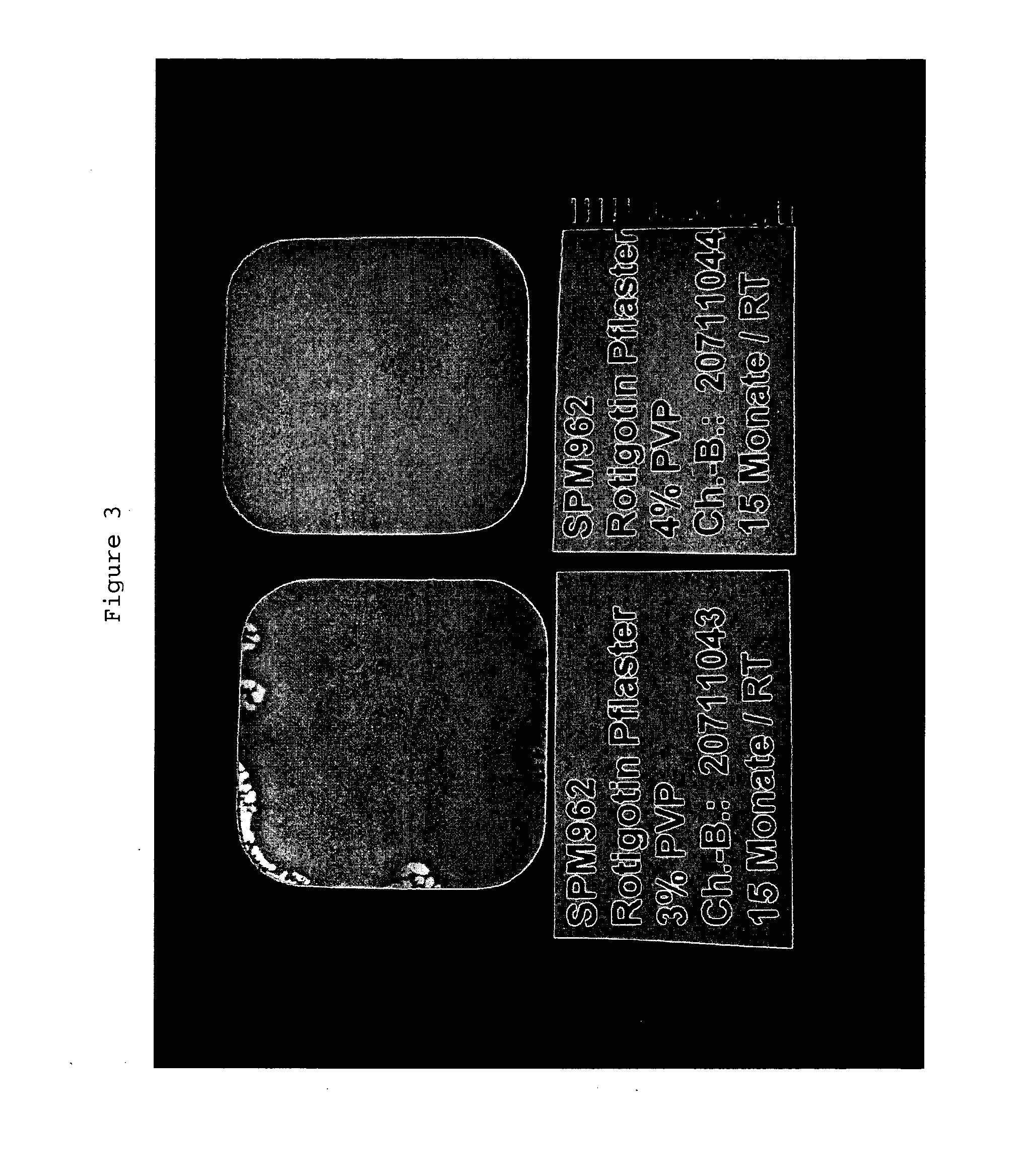 Polyvinylpyrrolidone for the stabilization of a solid dispersion of the non-crystalline form of rotigotine