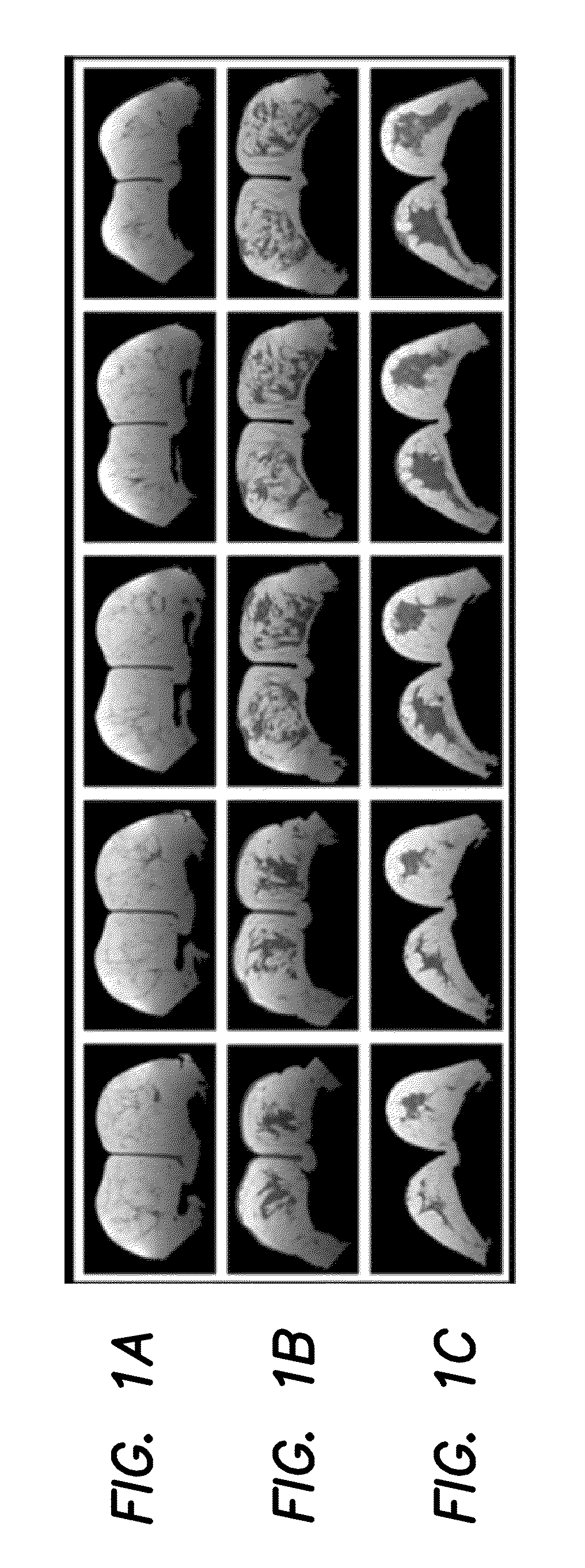 Method and Apparatus for Quantitative Analysis of Breast Density Morphology Based on MRI