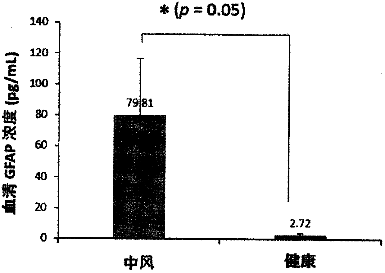 Luminescent ELISA in vitro diagnosis reagent kit for cerebral apoplexy and in vitro test equipment