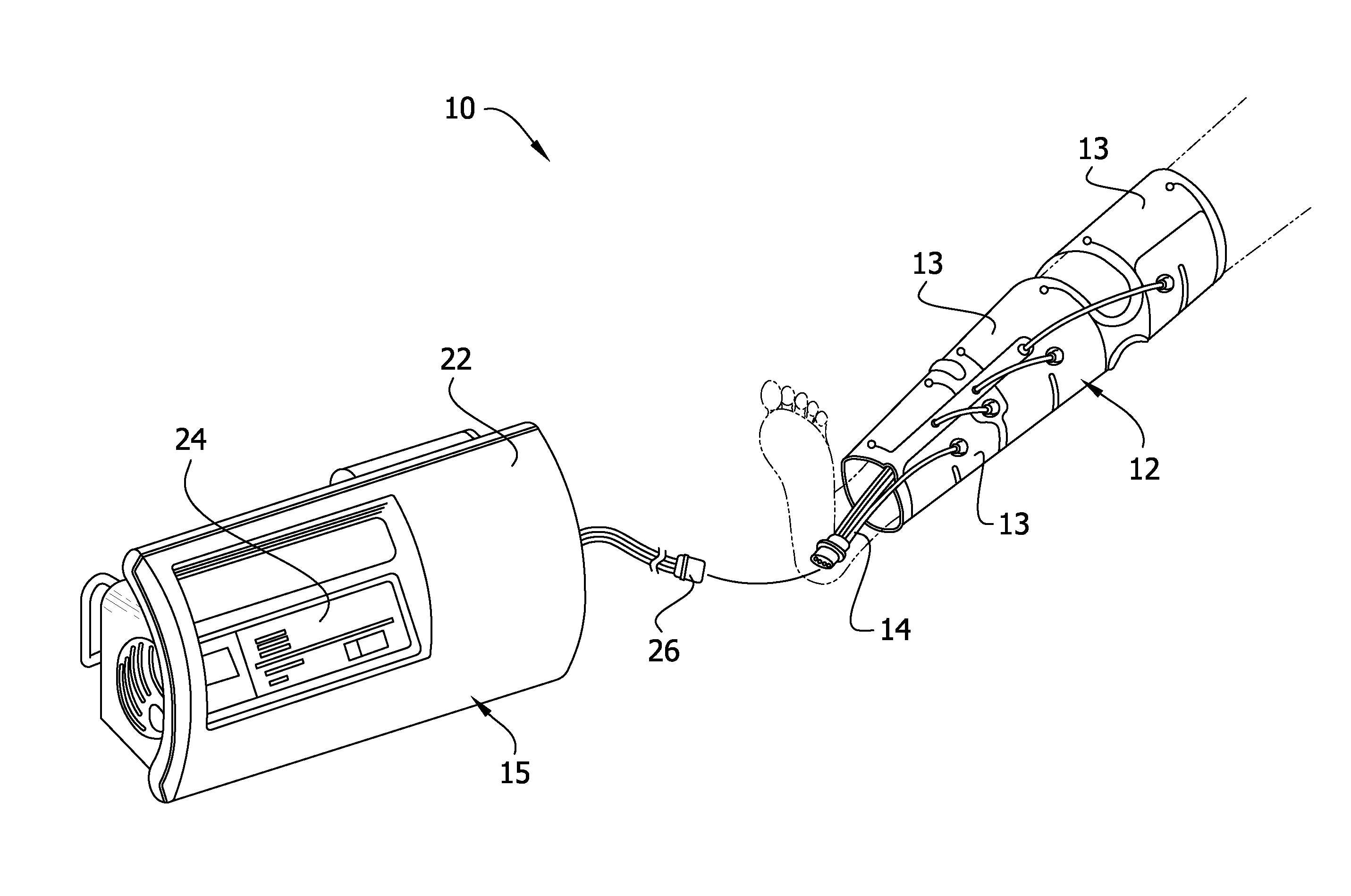 Venous Augmentation System