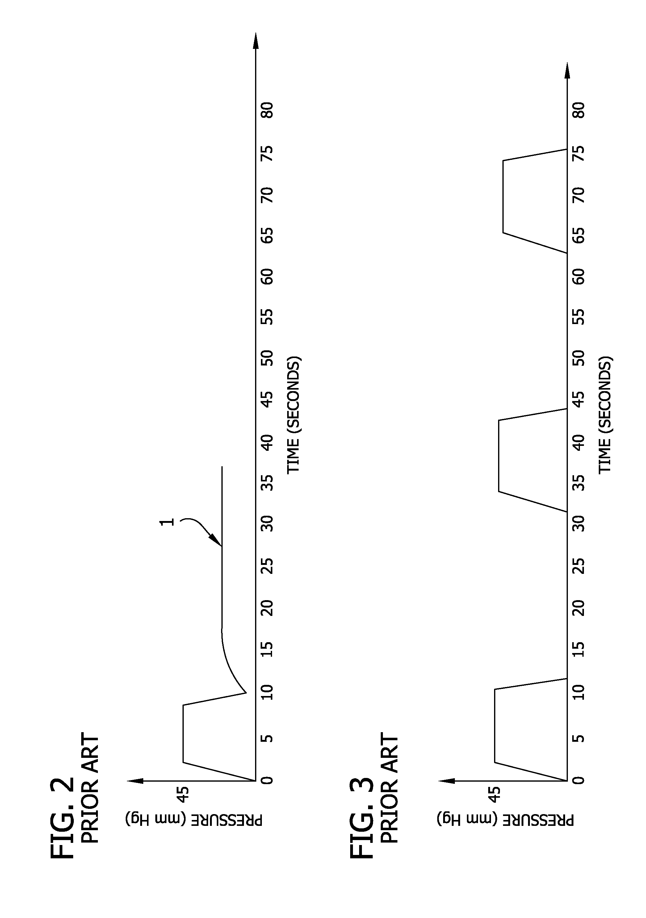 Venous Augmentation System