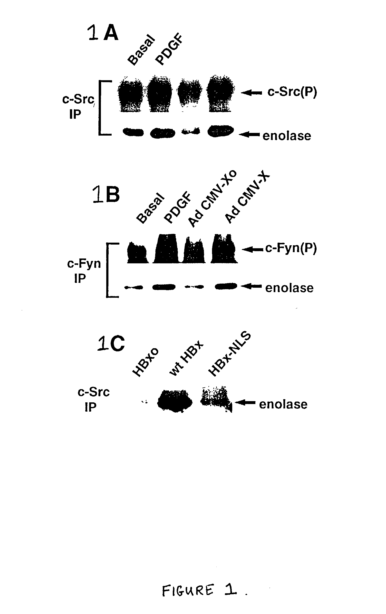 Inhibition of the Src kinase family pathway as a method of treating HBV infection and hepatocellular carcinoma