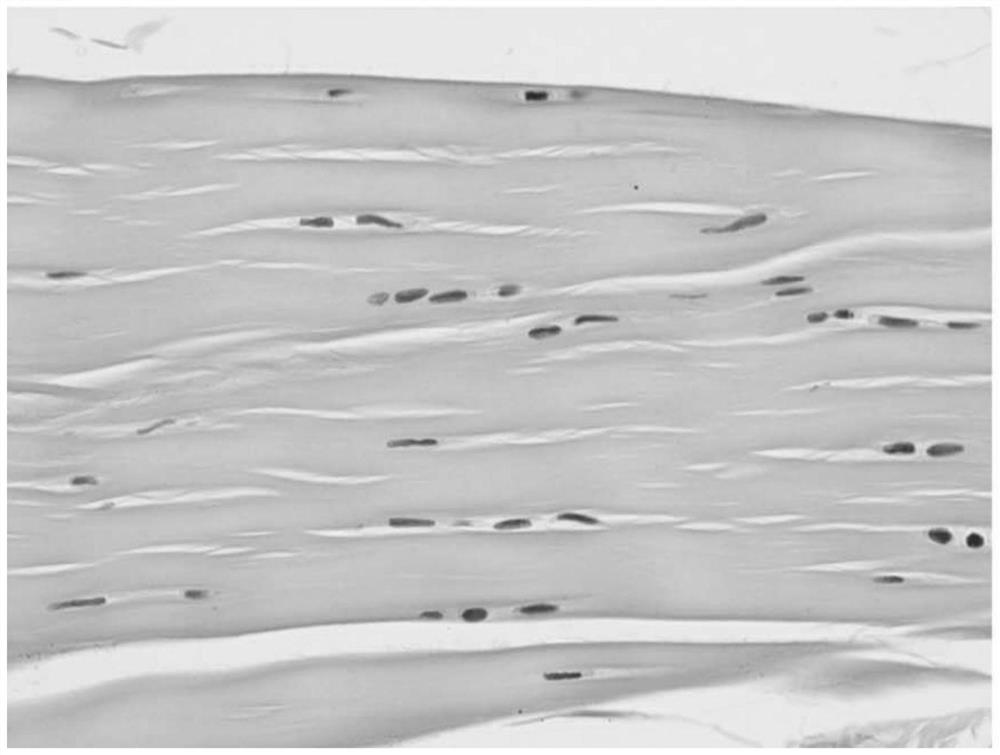 Preparation method of allogeneic or xenogeneic tendon and bone tendon complex