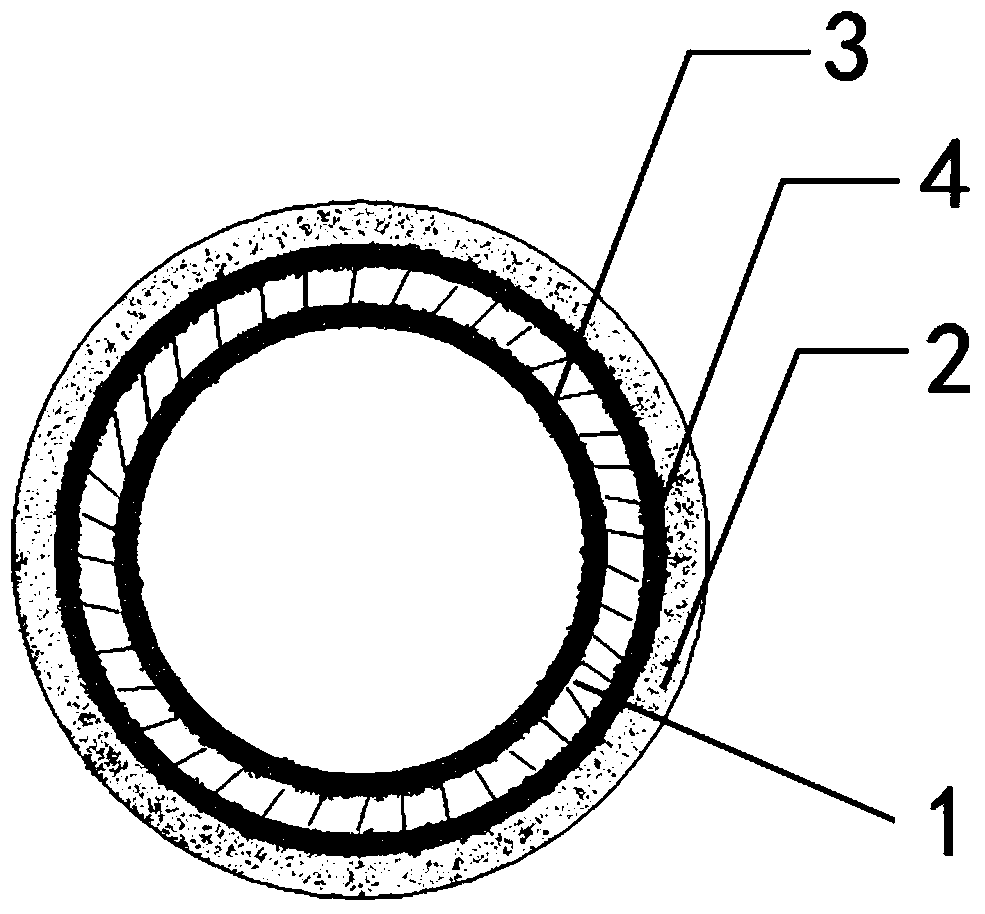 A multi-coated biodegradable metal stent and its preparation method
