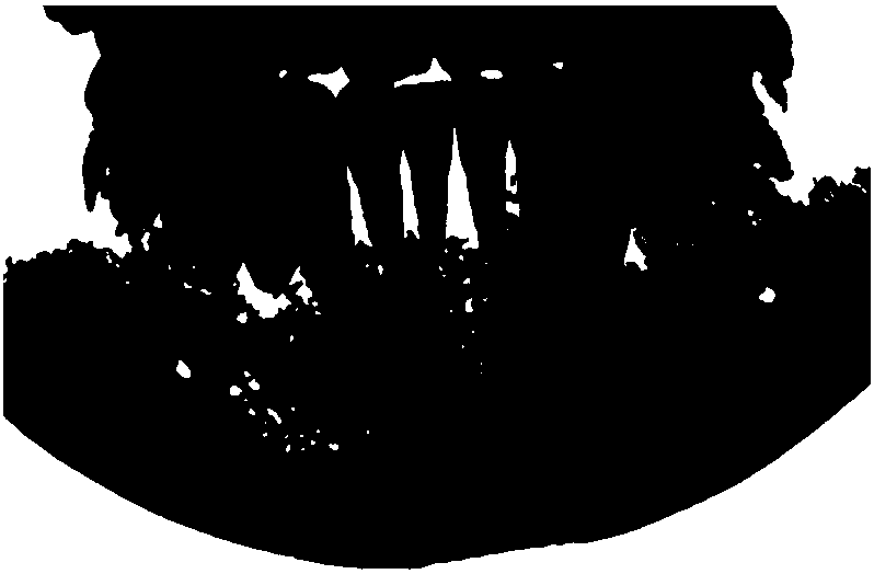 DICM data based tooth jaw system finite element modeling method