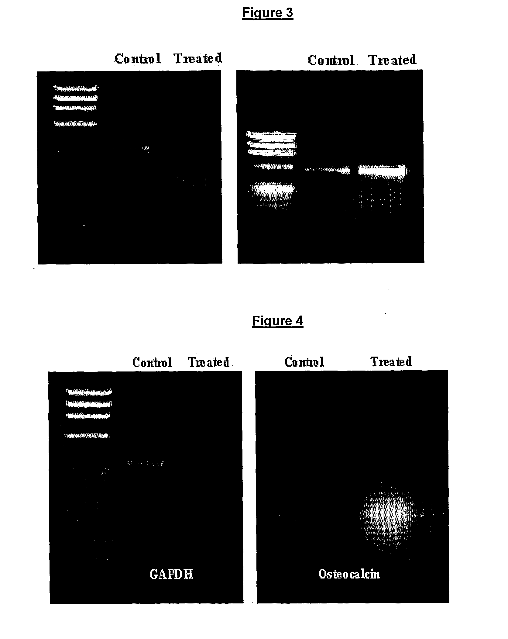 Pharmaceutical Composition for the Prevention/Treatment of Bone Disorders and a Process for the Preparation Thereof