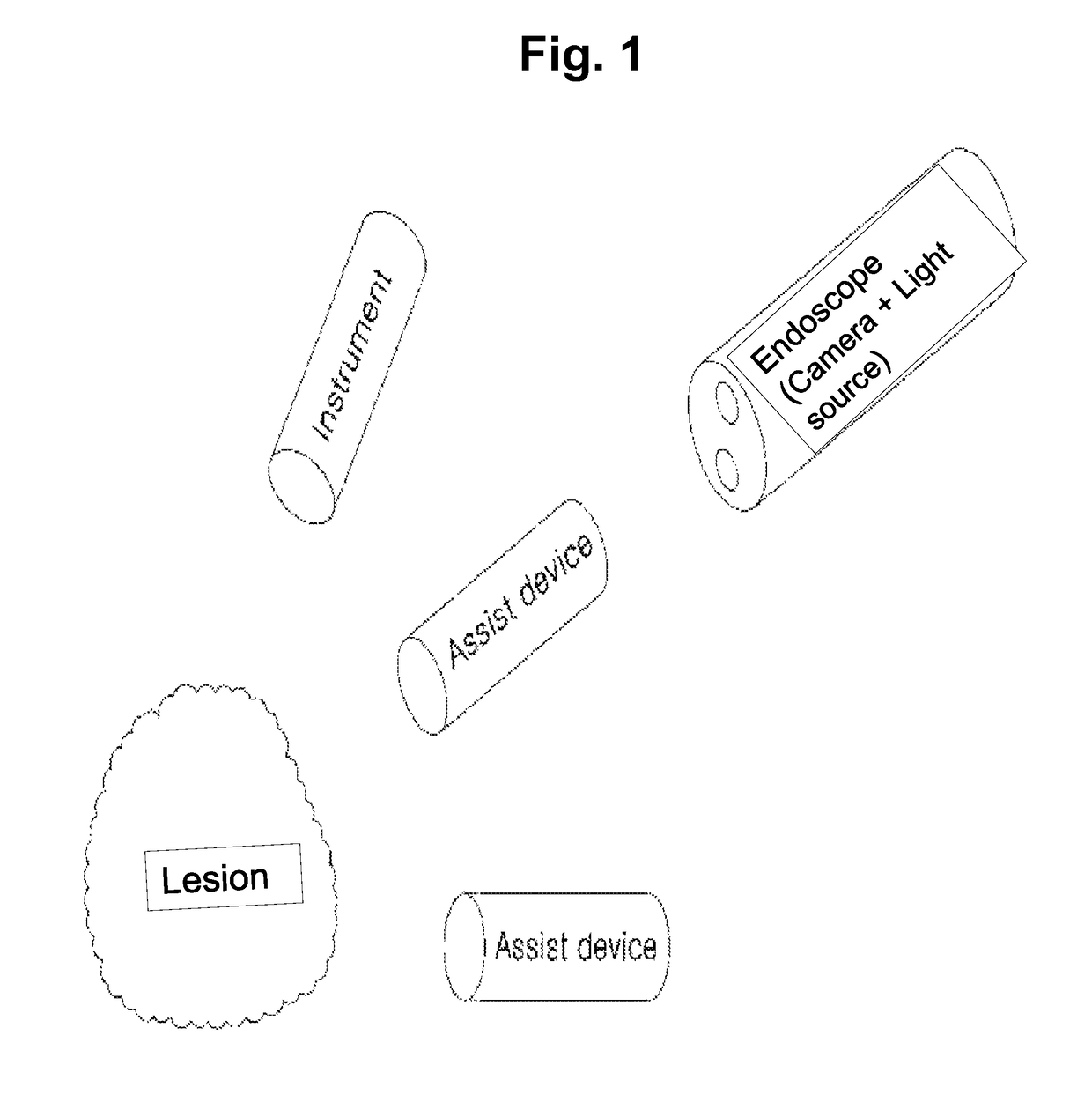 Device for three dimensional endoscopic surgery