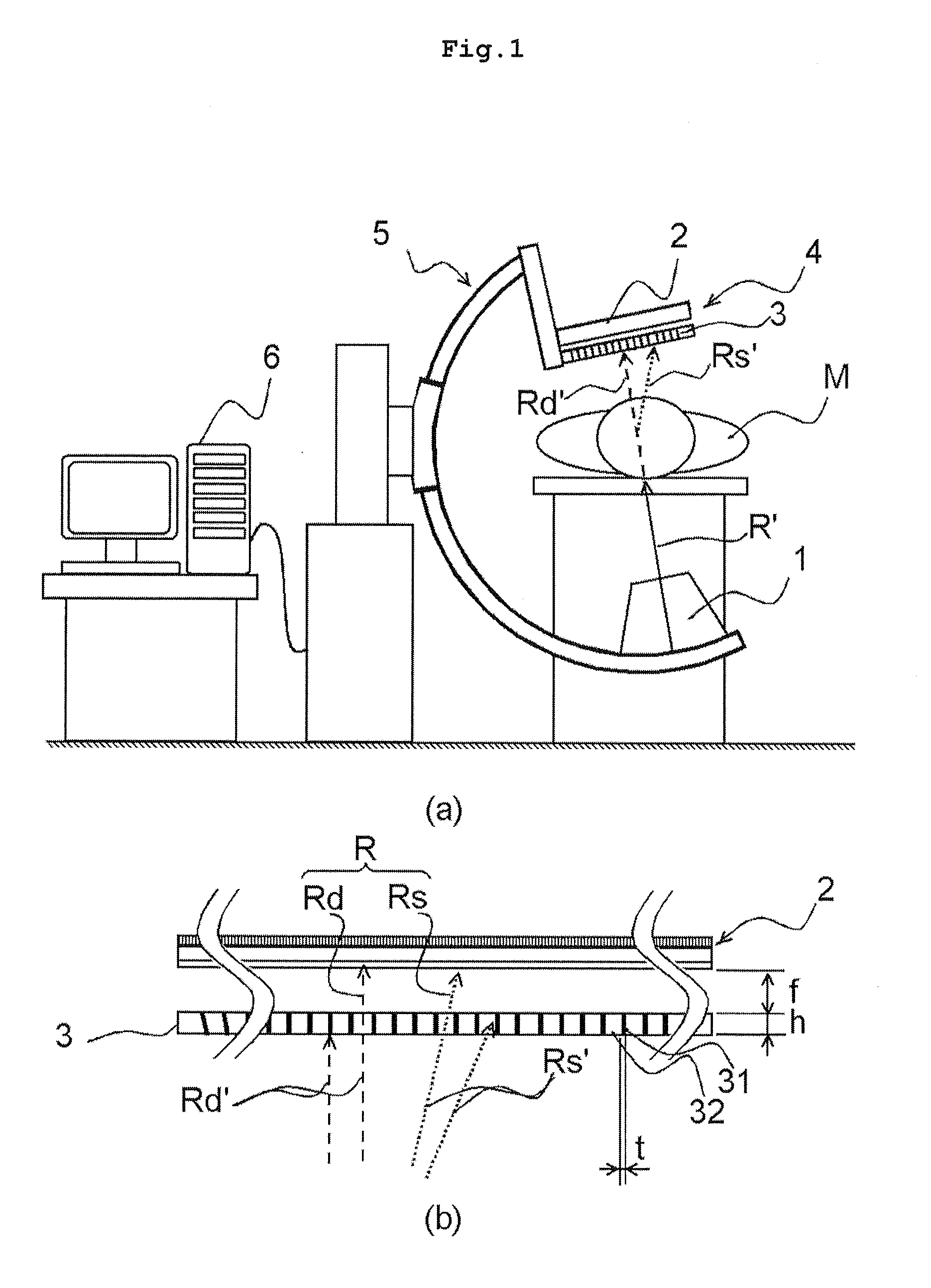 Radiation imaging apparatus