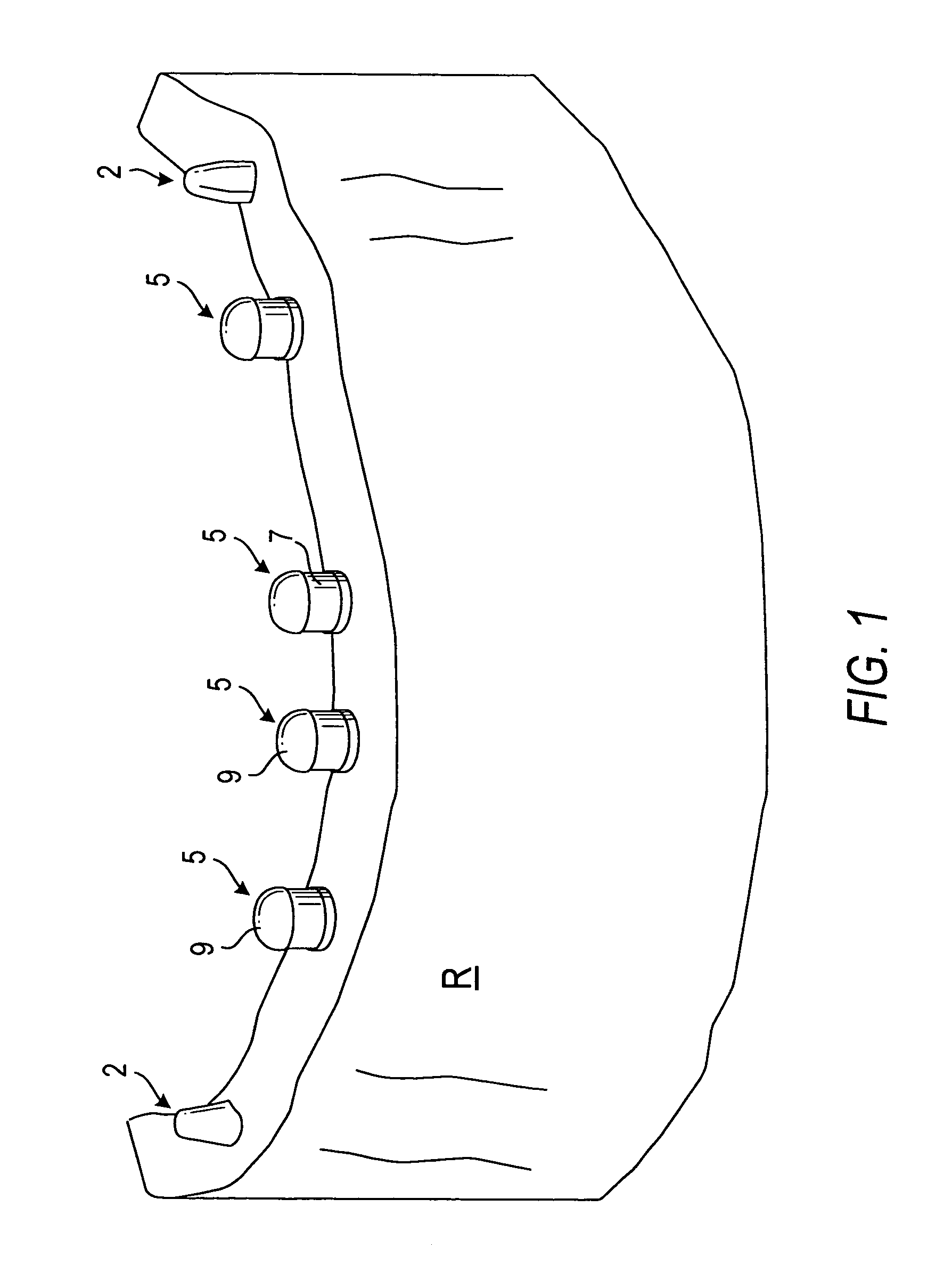 Components for permanent removable and adjustable dentures and bridges