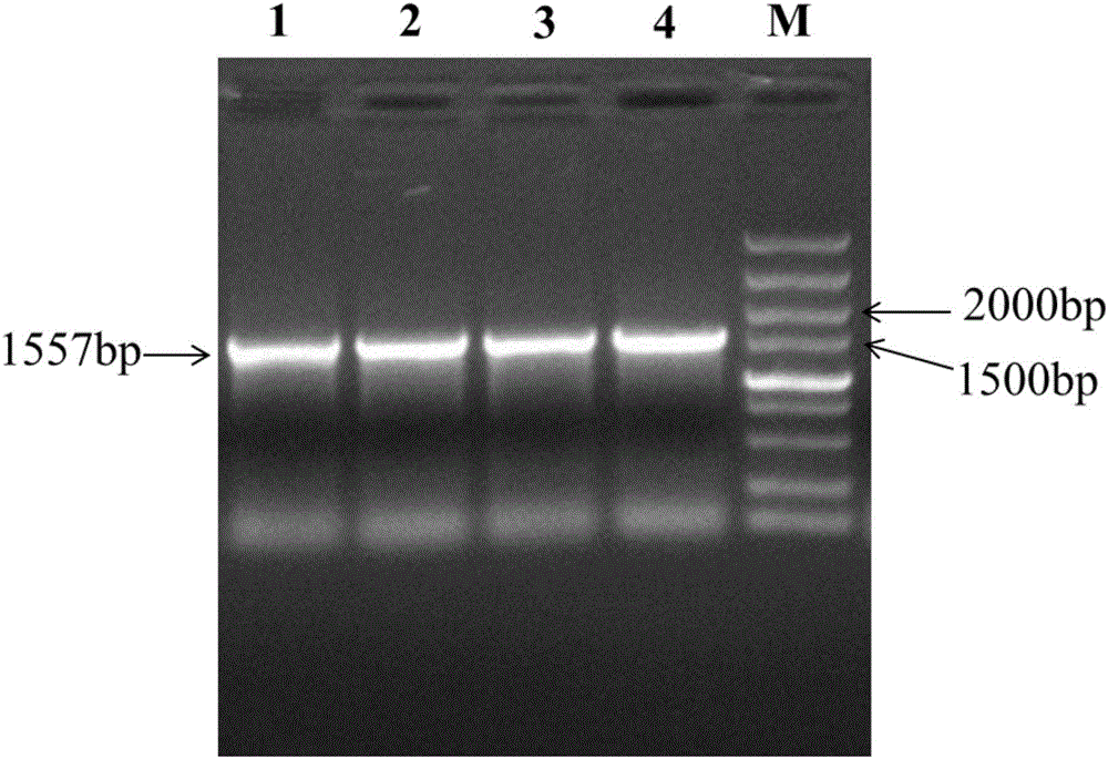 Genetically engineered bacterium used for producing 3-hydroxypropionic acid (3-HP) by fermentation, constructing method and application of genetically engineered bacterium