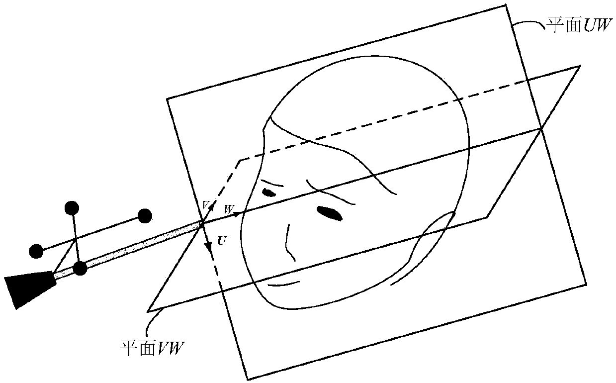 Image display method, device and system for endoscopic minimally invasive surgical navigation