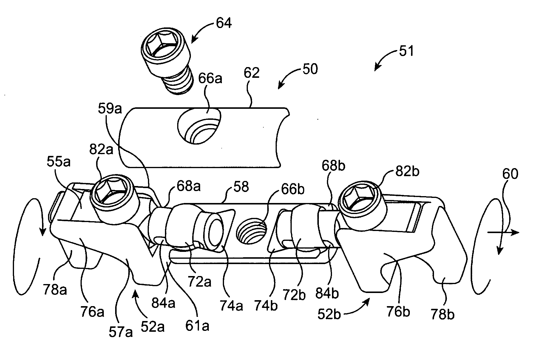 System and methods for posterior dynamic stabilization of the spine