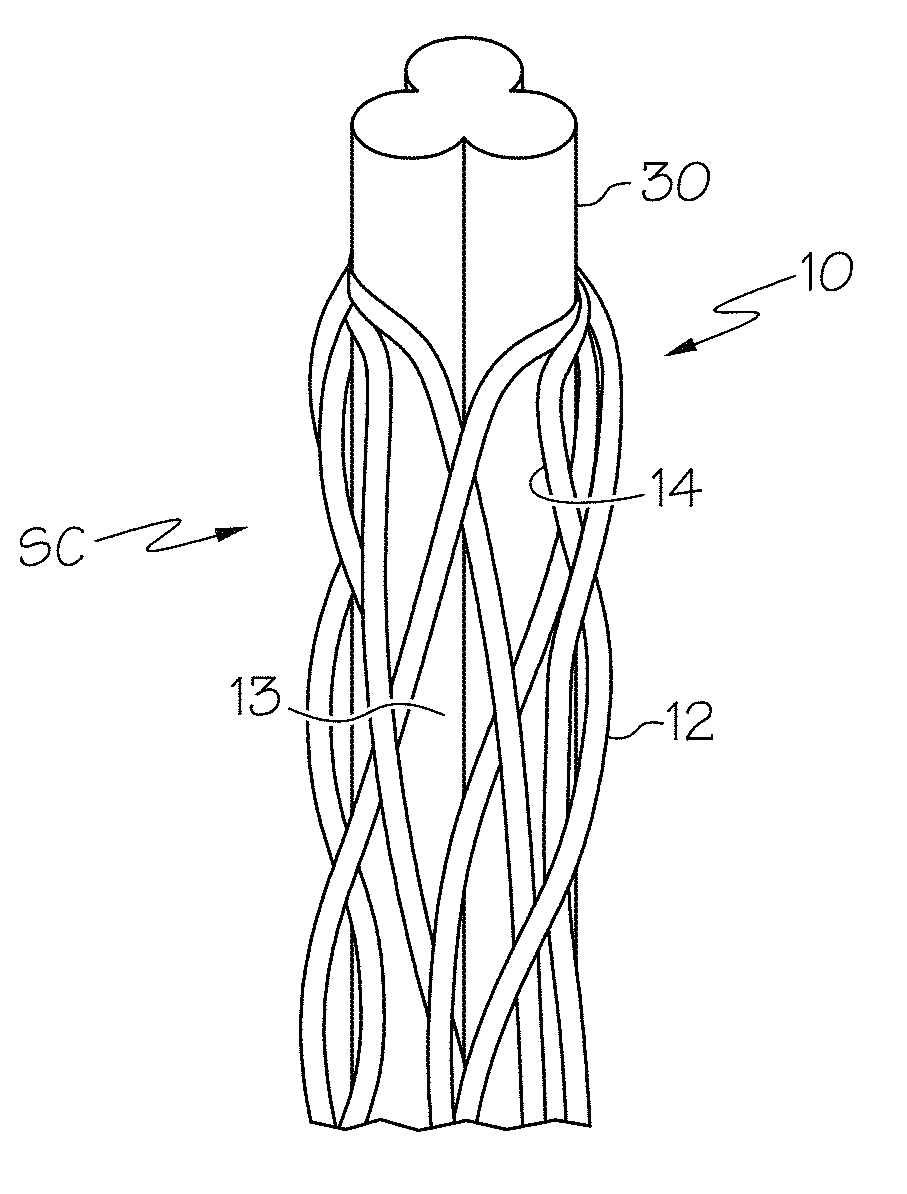 Monofilament-reinforced hollow fiber membrane with scalloped lumen