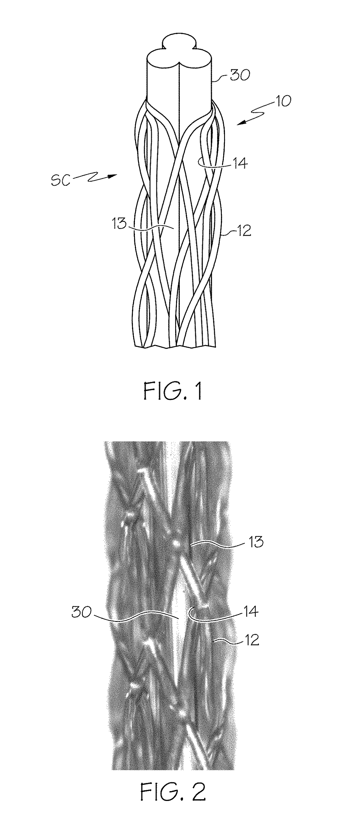 Monofilament-reinforced hollow fiber membrane with scalloped lumen