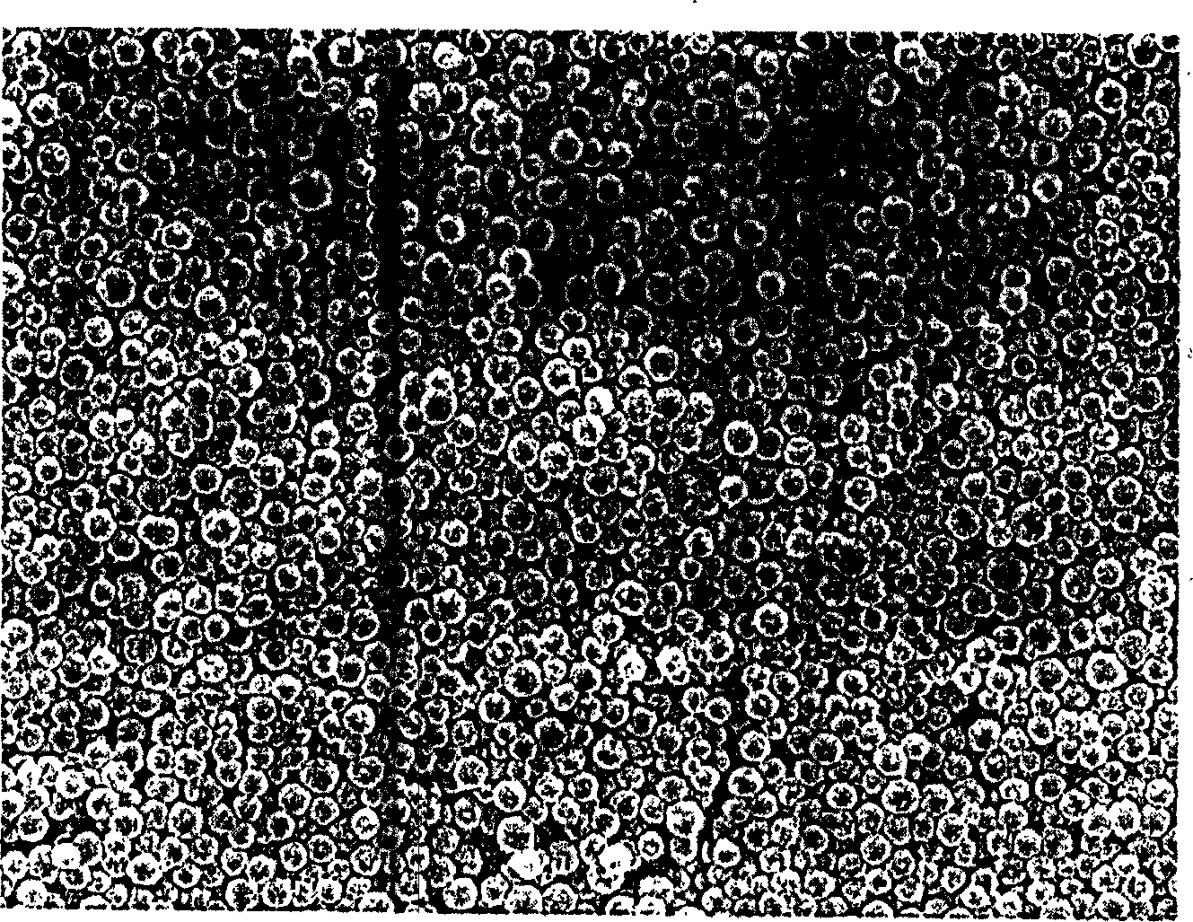 Dimaleimide resin microball, its preparation method and application thereof