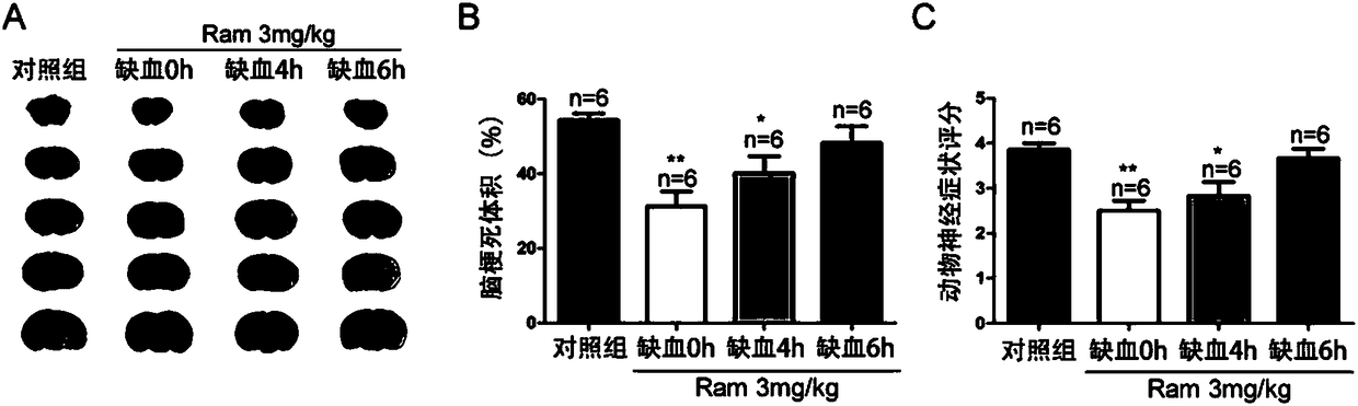 Application of ramelteon in preparation of drug for treating ischemic brain injury