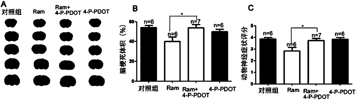 Application of ramelteon in preparation of drug for treating ischemic brain injury