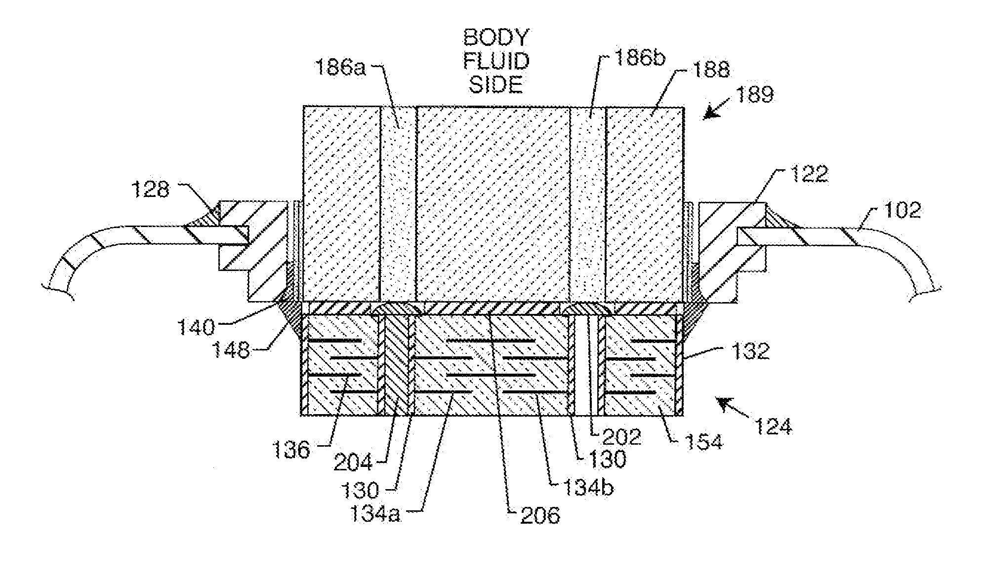 Co-fired hermetically sealed feedthrough with alumina substrate and platinum filled via for an active implantable medical device