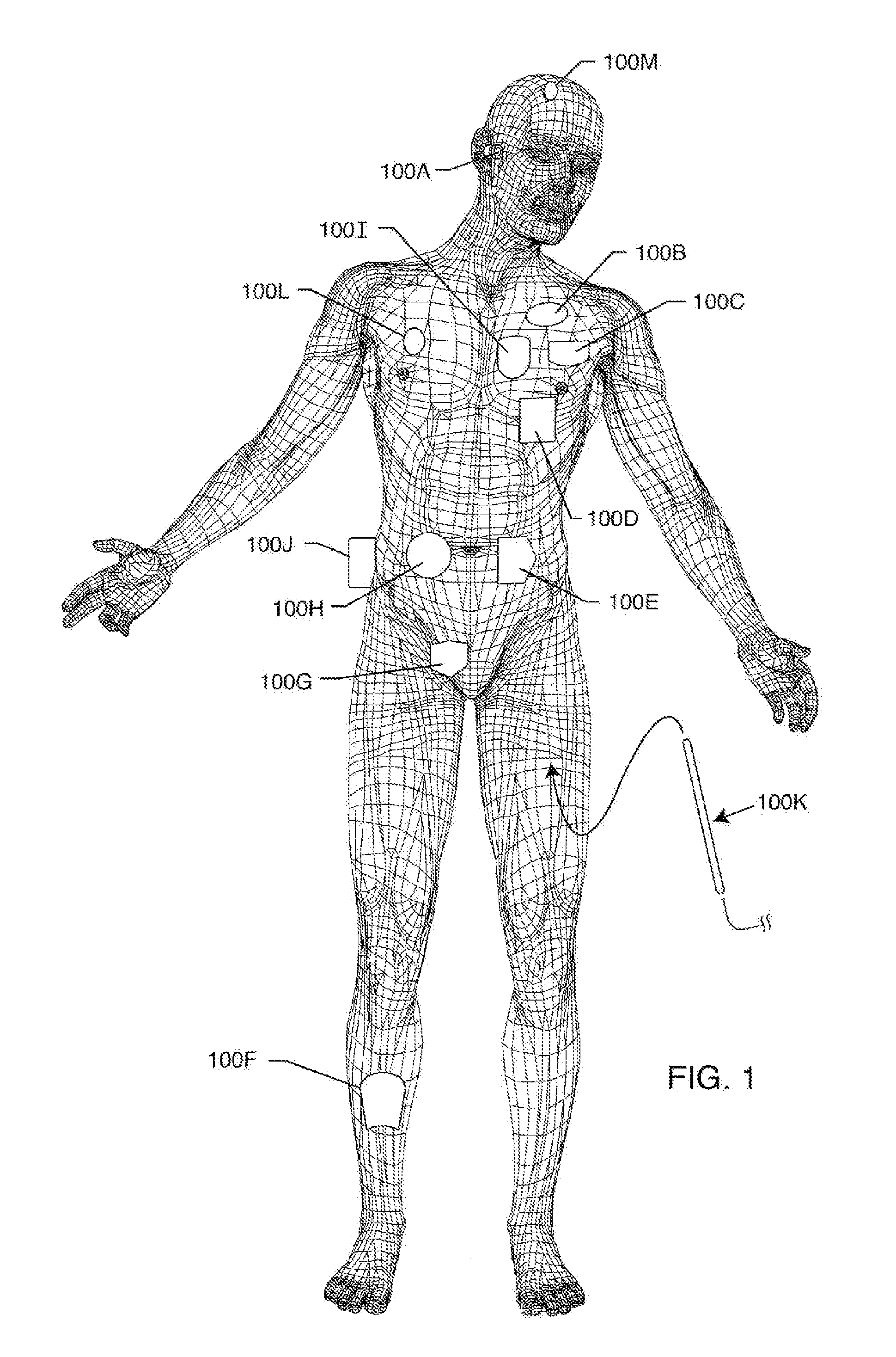 Co-fired hermetically sealed feedthrough with alumina substrate and platinum filled via for an active implantable medical device