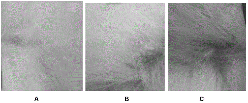 Breast nodule treatment medicine composition and preparation process and application thereof