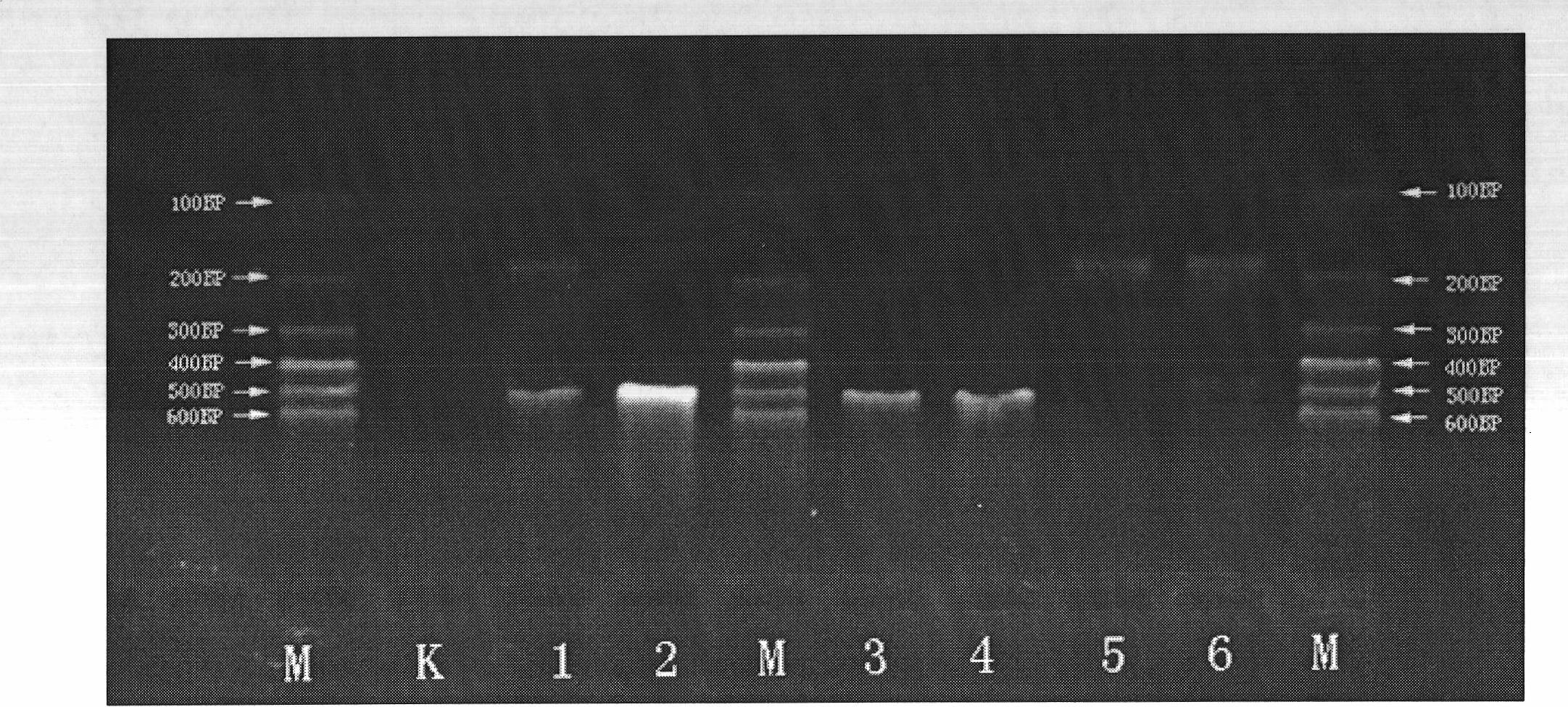 Multiple polymerase chain reaction (PCR) kit and method for detecting mosquito-borne pathogens