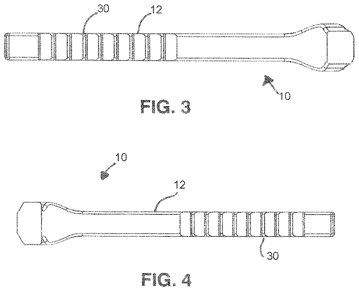 Reinforced bridge superelastic bone compression staple and inserter system