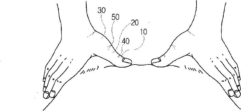 A thumb assistance device for acupressure