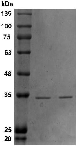 Alkaline urate oxidase and applications thereof to detection kit and reduction of uric acid in foods