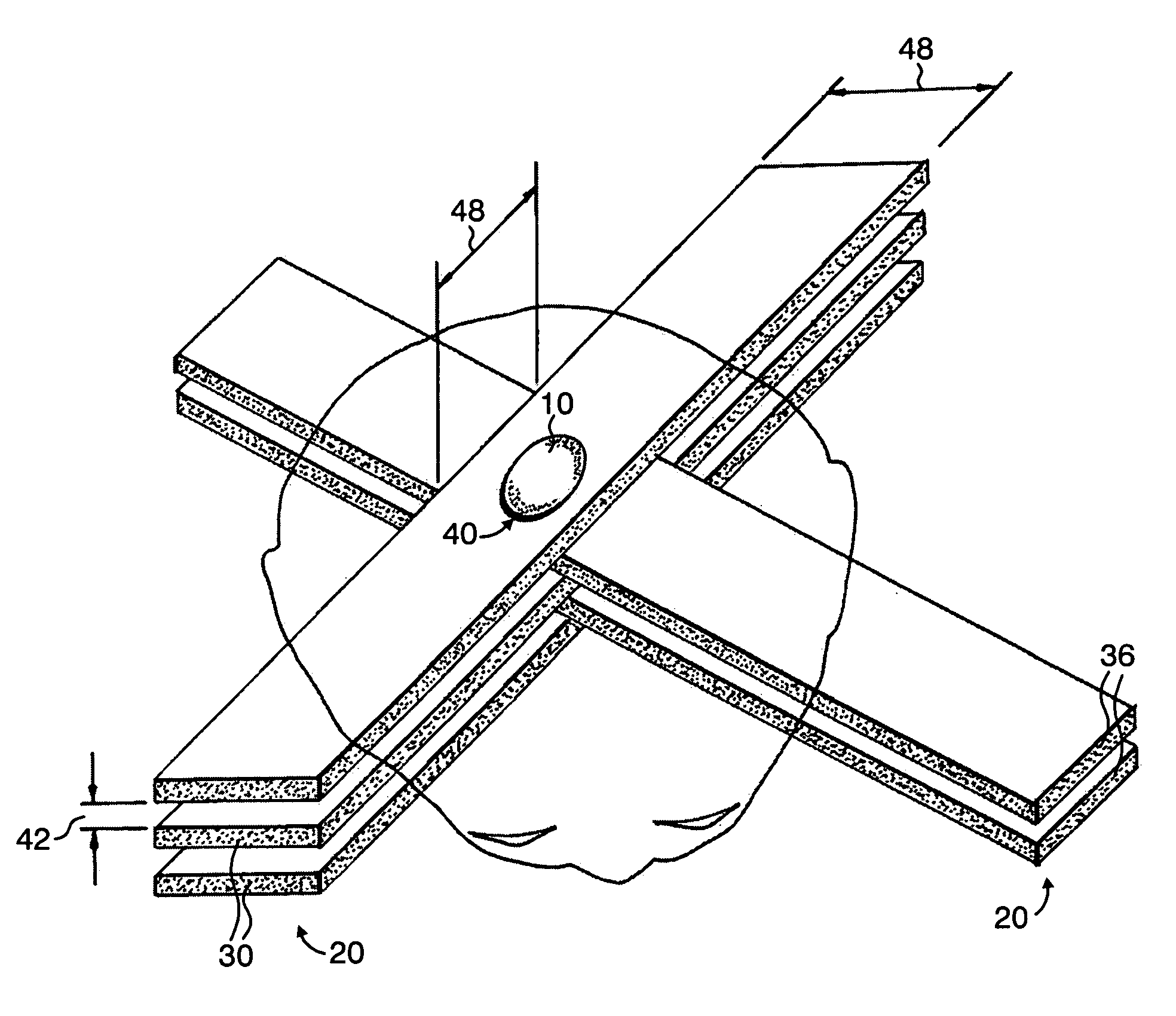 Methods for implementing microbeam radiation therapy