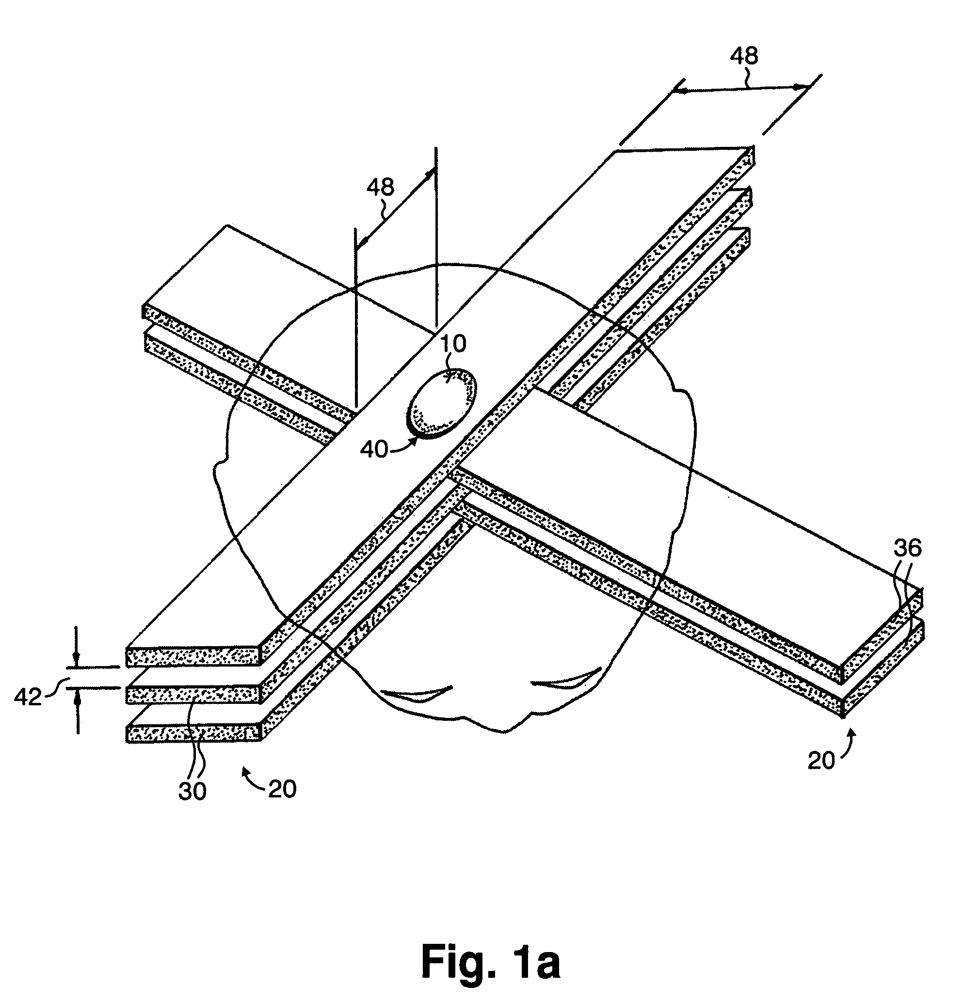 Methods for implementing microbeam radiation therapy