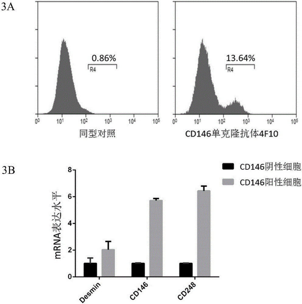 Application of CD146 monoclonal antibody in detection and separation and identification of glioma perivascular cells