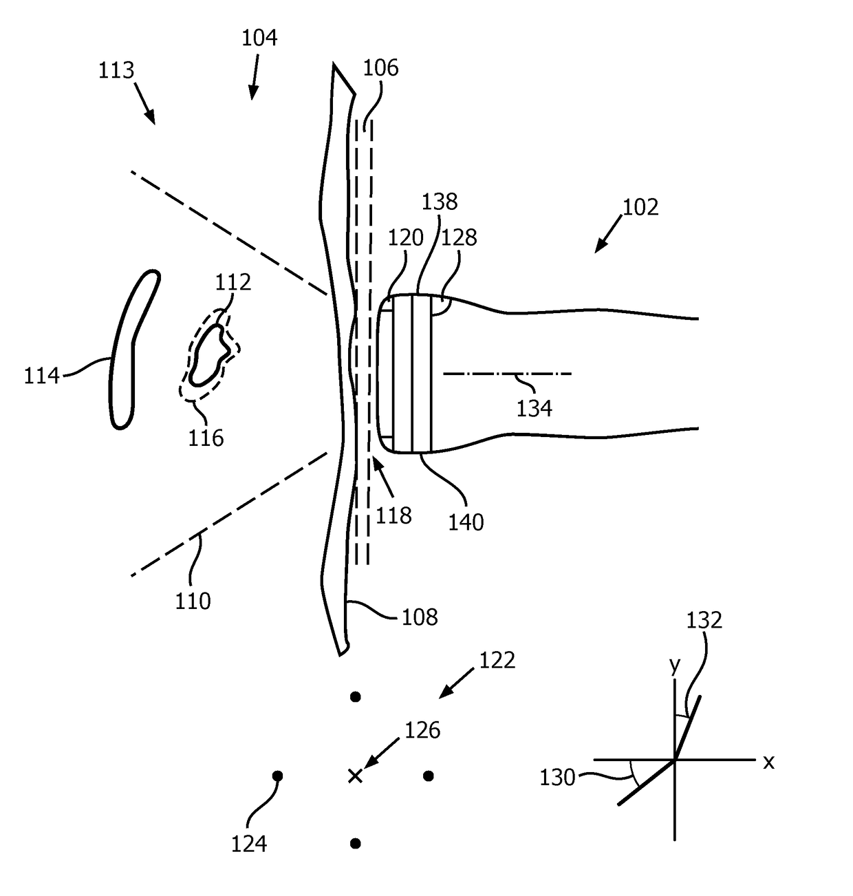 Consistent sequential ultrasound acquisitions for intra-cranial monitoring