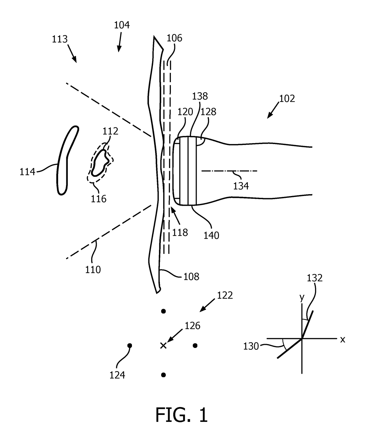 Consistent sequential ultrasound acquisitions for intra-cranial monitoring