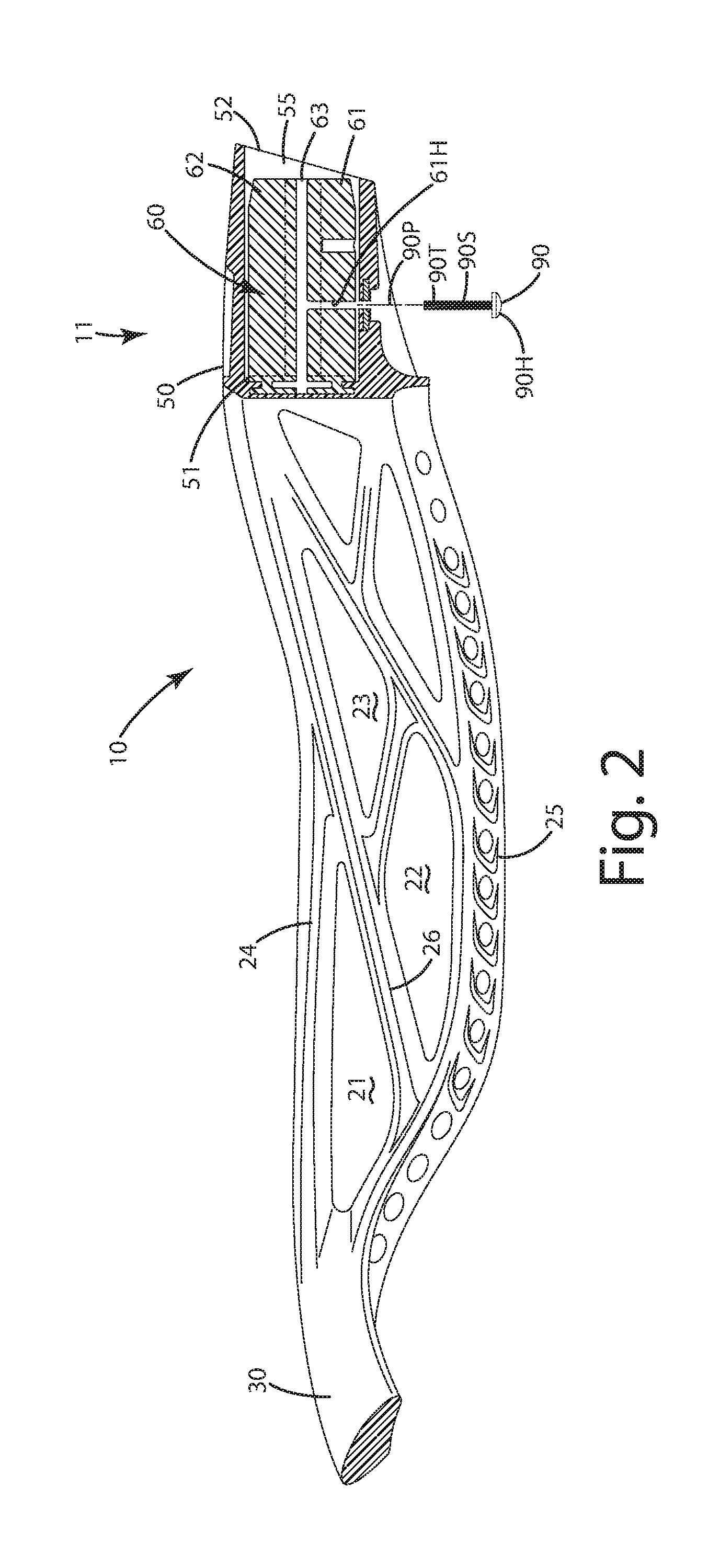 Lacrosse head to handle attachment