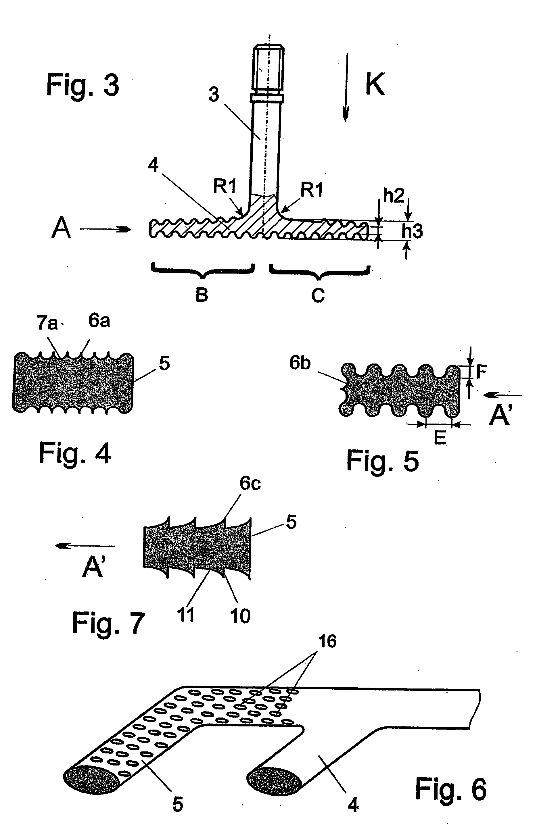 Bone-adaptive surface structure