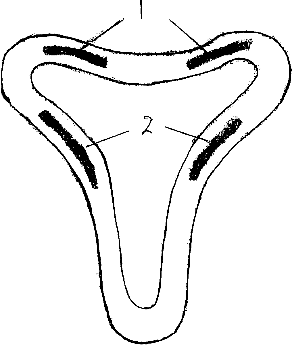 Intrauterine device compromising nano-copper