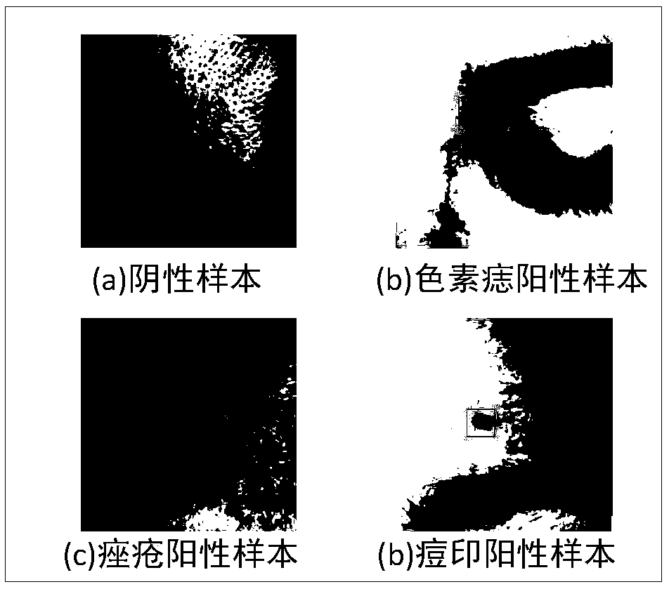 Method and device for detecting spot defect of face skin based on deep learning